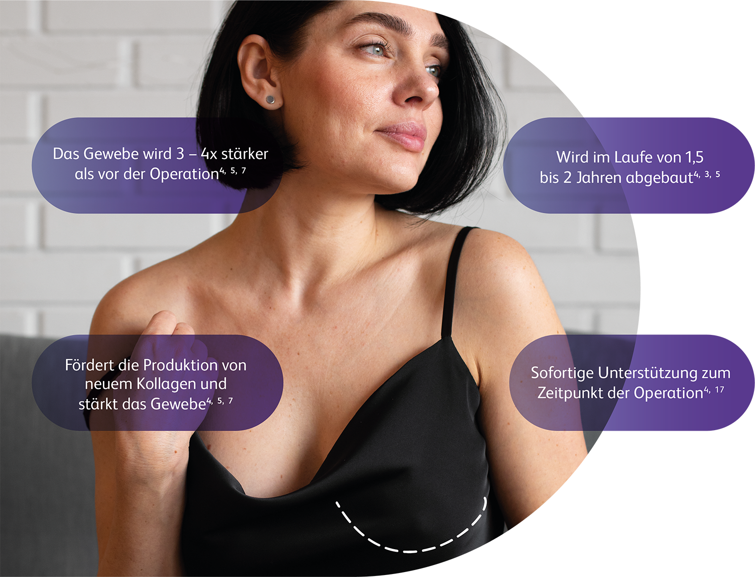 GalaFLEX® Scaffold – präklinische Daten zur Kollagenbildung und Stabilität des Inneren BH (18–24 Monate Resorption, 3–4-fach stärkeres Gewebe)